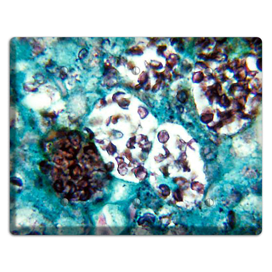 Histoplasmosis Capsulatum 3 Blank Wallplate