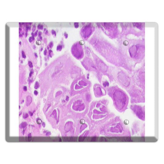 Esophagus Herpes 3 Blank Wallplate