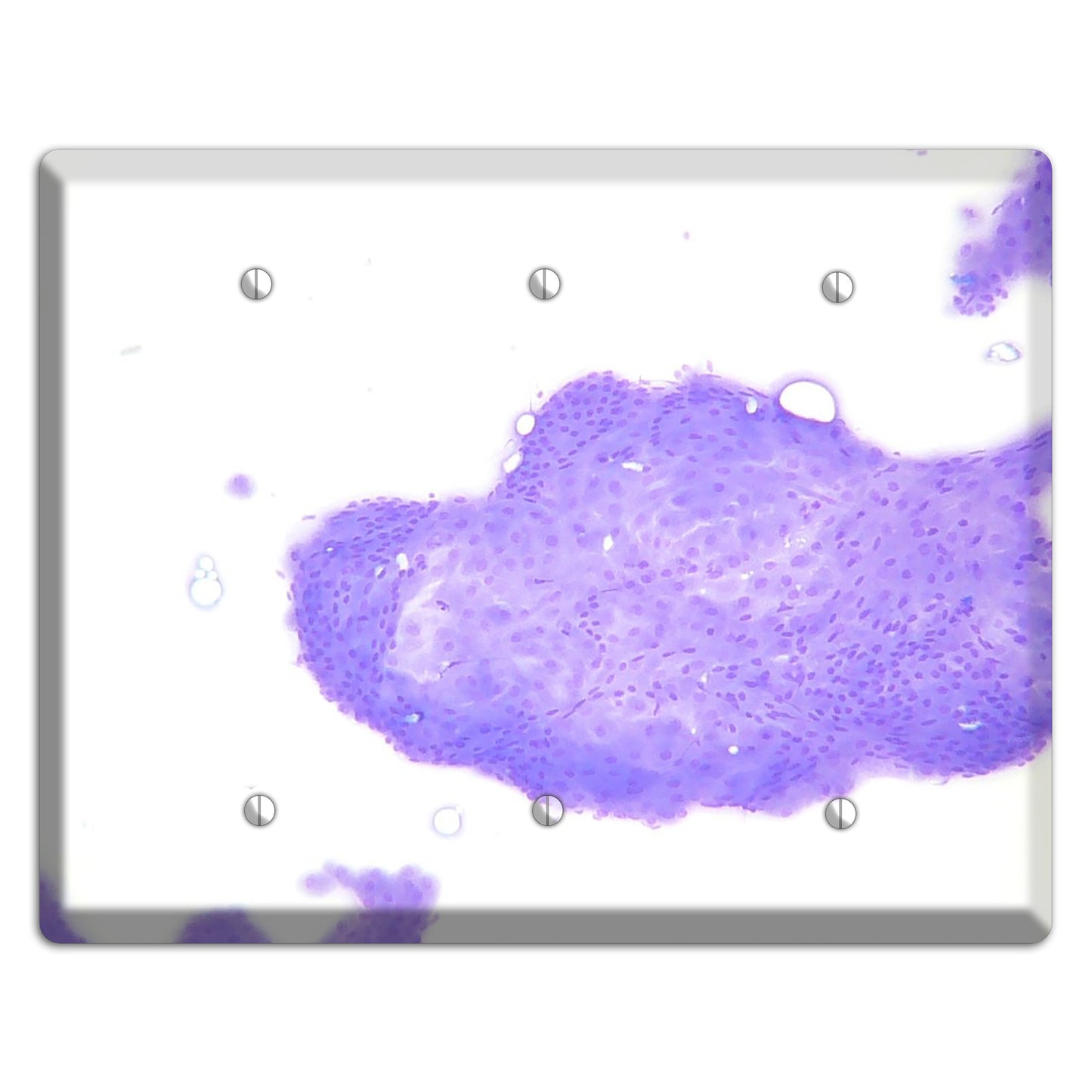 Perianal Gland Tumor Cytology 3 Blank Wallplate