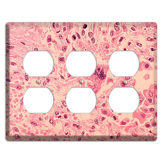 Measles Pneumonia 3 Duplex Wallplate