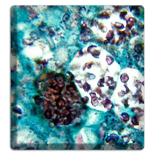 Histoplasmosis Capsulatum 2 Blank Wallplate