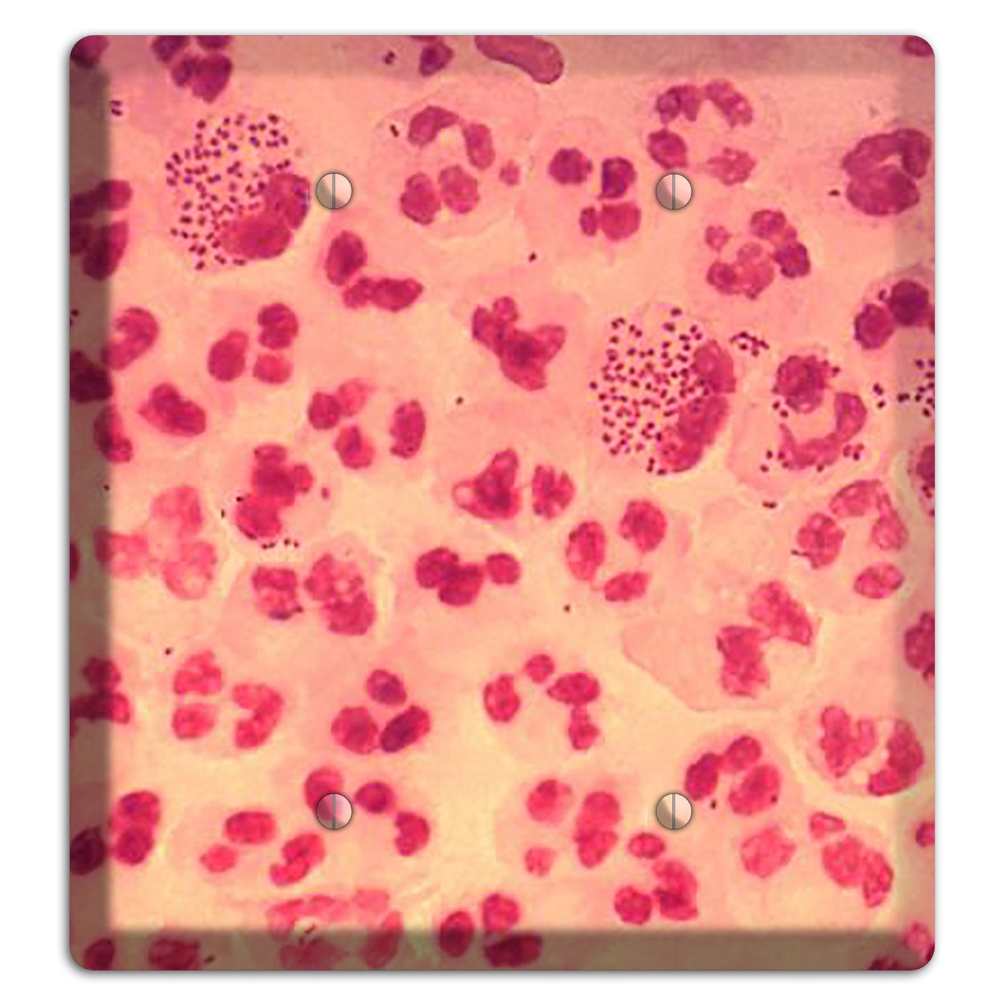 Gonococcal Urethritis 2 Blank Wallplate