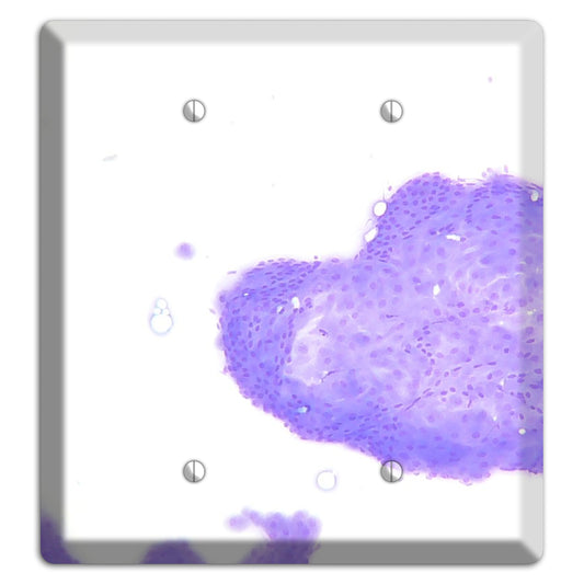 Perianal Gland Tumor Cytology 2 Blank Wallplate