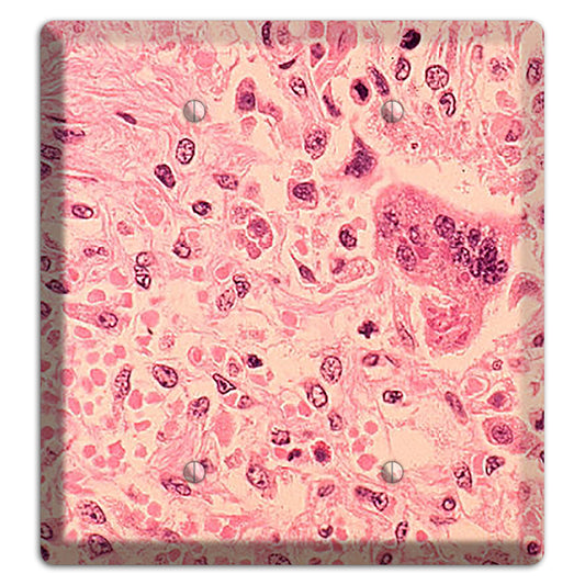 Measles Pneumonia 2 Blank Wallplate