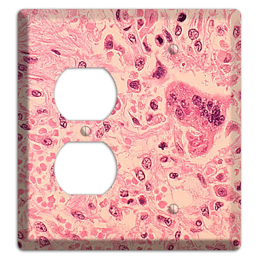 Measles Pneumonia Duplex / Blank Wallplate