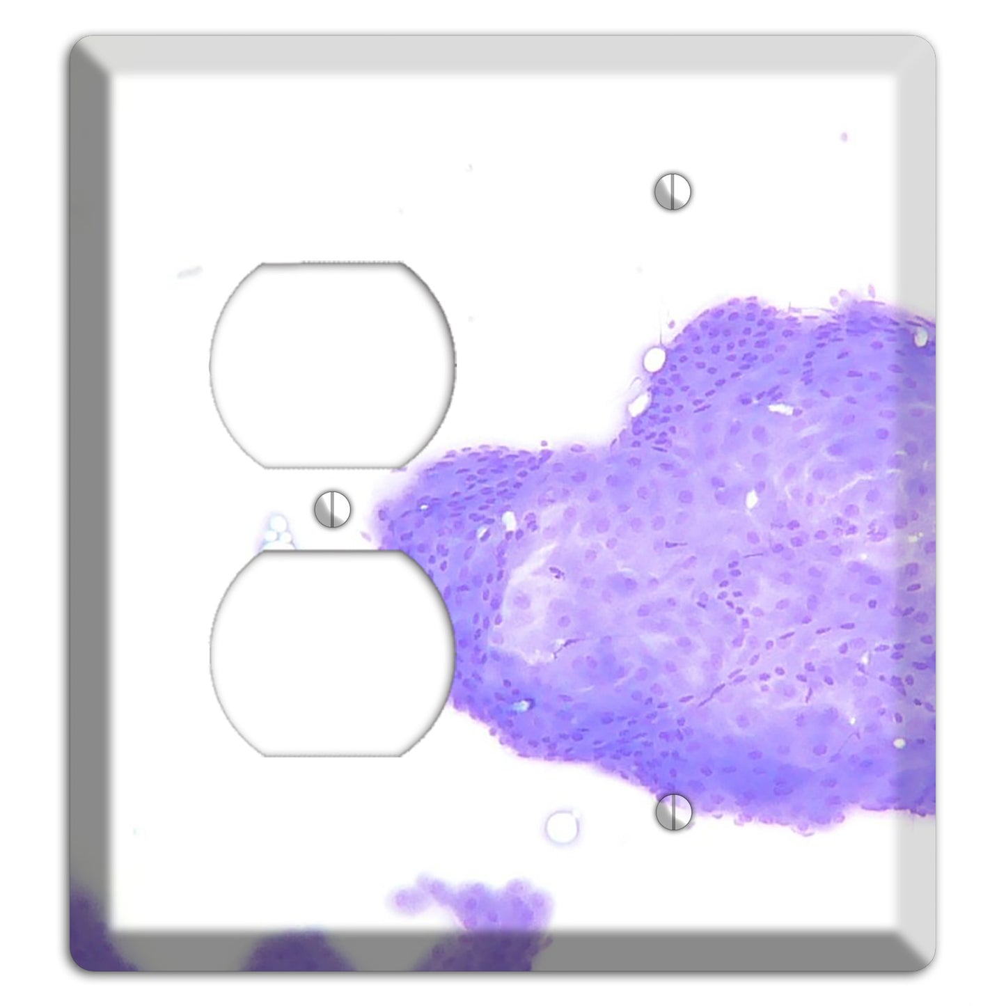 Perianal Gland Tumor Cytology Duplex / Blank Wallplate