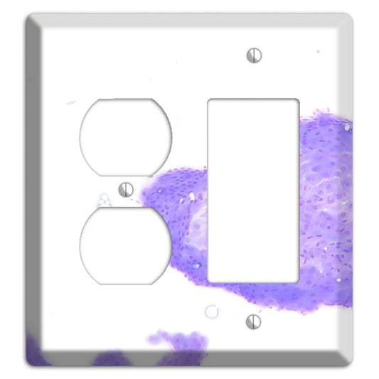 Perianal Gland Tumor Cytology Duplex / Rocker Wallplate