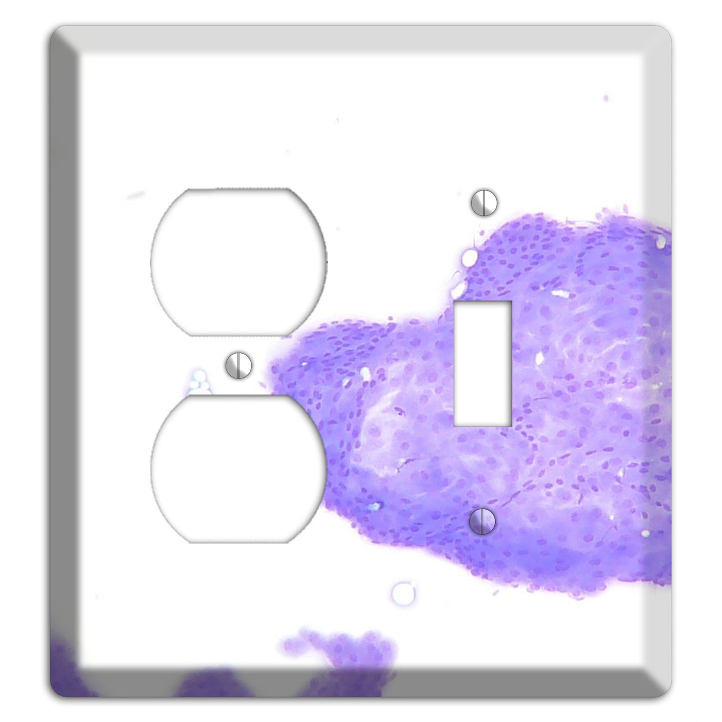 Perianal Gland Tumor Cytology Duplex / Toggle Wallplate