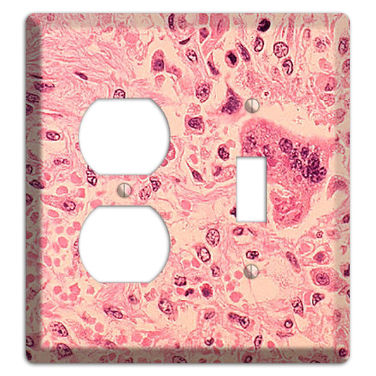 Measles Pneumonia Duplex / Toggle Wallplate