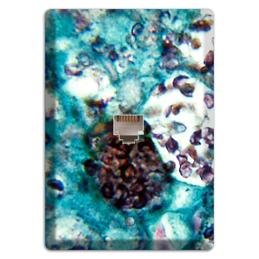 Histoplasmosis Capsulatum Phone Wallplate