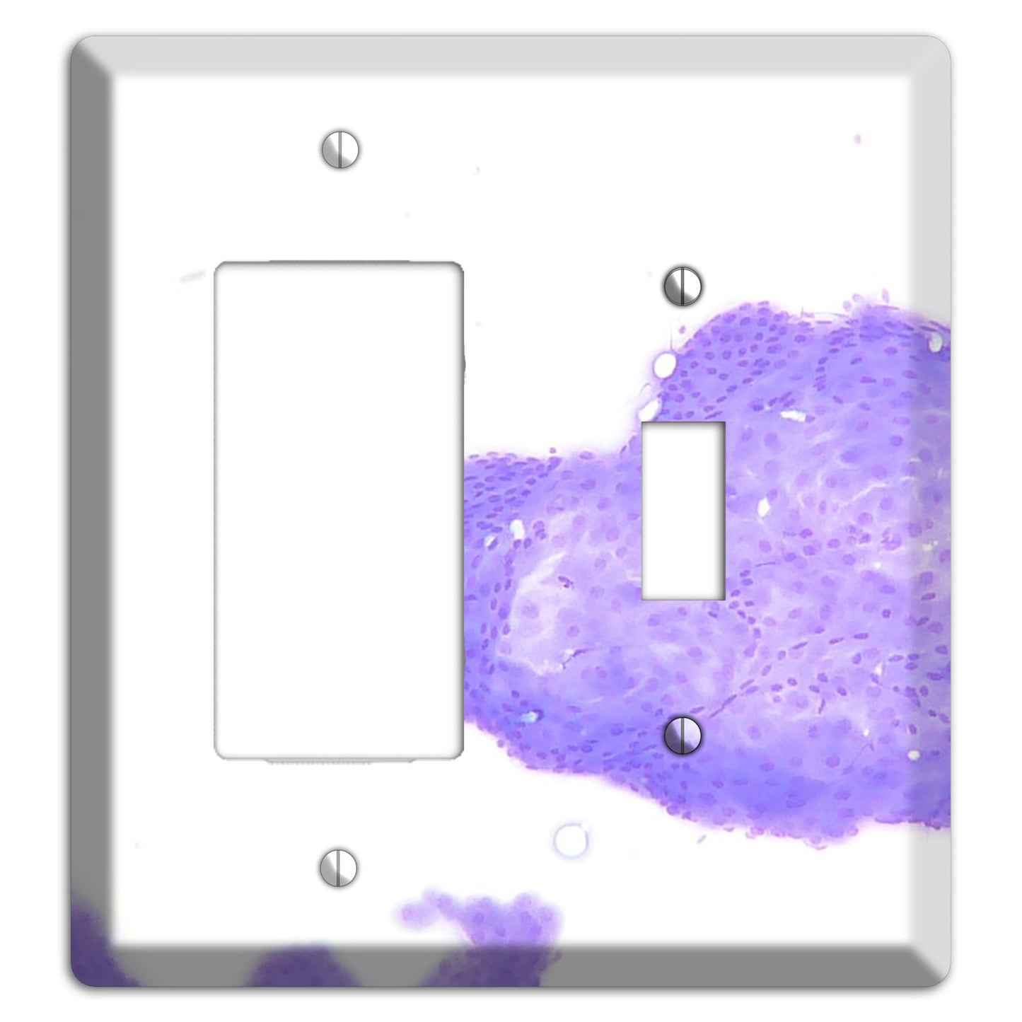 Perianal Gland Tumor Cytology Rocker / Toggle Wallplate