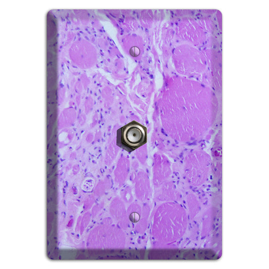 Poliovirus Myotonic Dystrophic Cable Wallplate