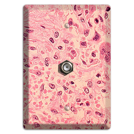 Measles Pneumonia Cable Wallplate