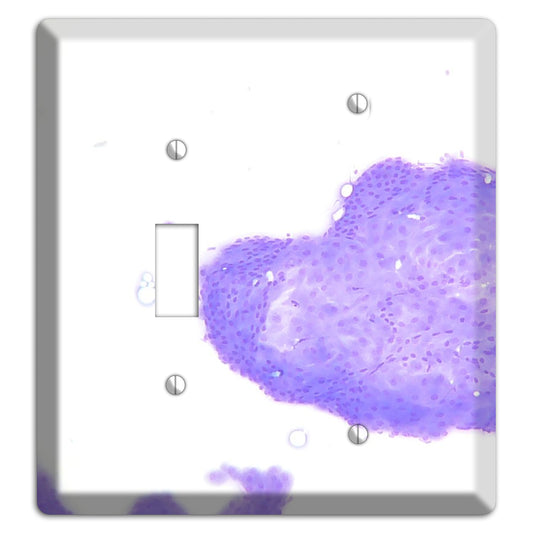 Perianal Gland Tumor Cytology Toggle / Blank Wallplate