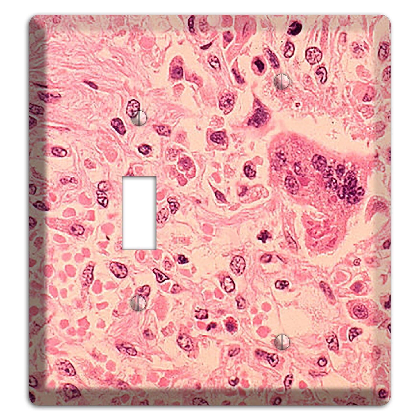 Measles Pneumonia Toggle / Blank Wallplate