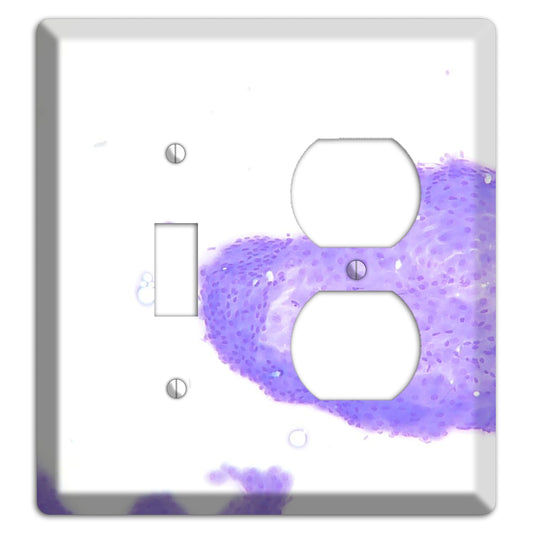 Perianal Gland Tumor Cytology Toggle / Duplex Wallplate