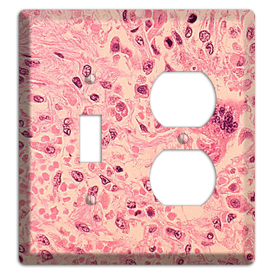 Measles Pneumonia Toggle / Duplex Wallplate