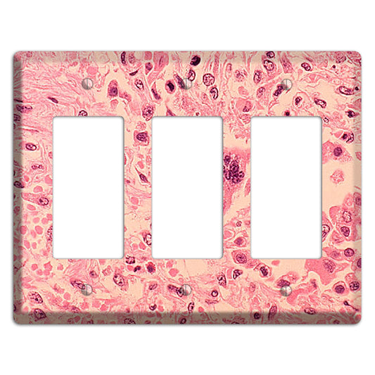 Measles Pneumonia 3 Rocker Wallplate