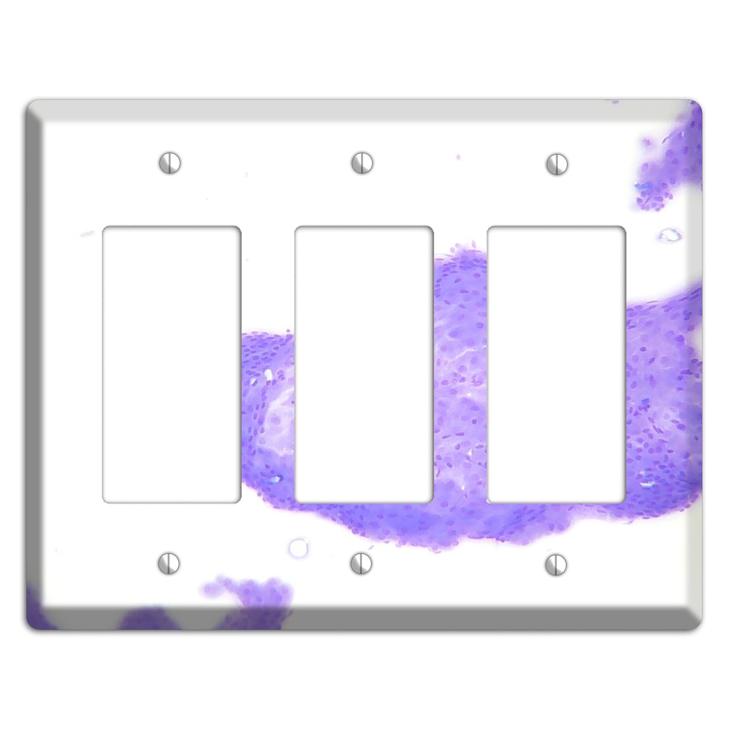 Perianal Gland Tumor Cytology 3 Rocker Wallplate